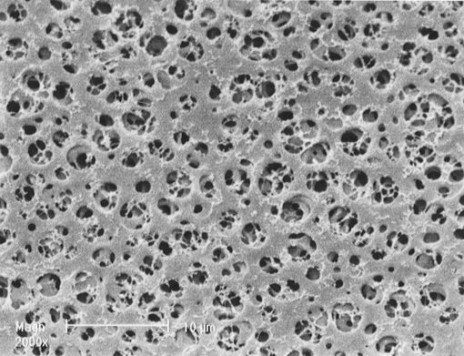 Filtro de membrana AC, no Esteril 0,45µm, 25 Ømm, x 100u.