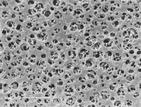 Filtro de membrana de acetato de celulosa (AC) 11106-293------G