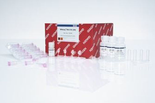 RNeasy Mini Kit - Purificacion de ARN a partir de celulas, tejidos y levaduras. 