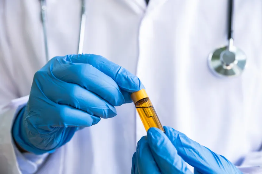 Aceite de Cannabis: Beneficios y contraindicaciones ¿Para qué enfermedades sirve?