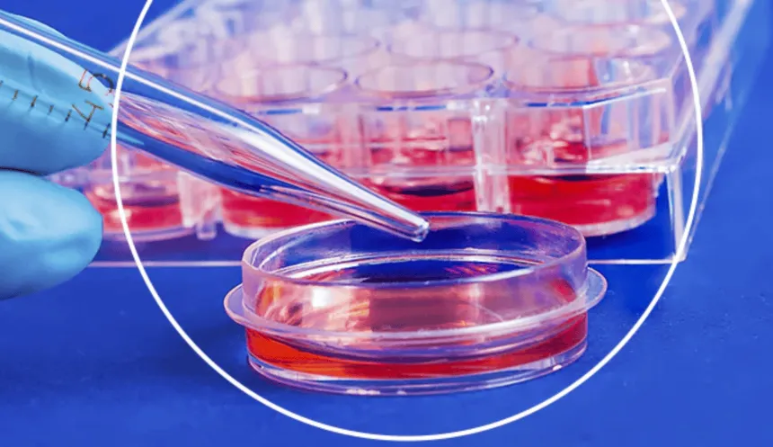 ¿Para qué sirve la Placa de petri en laboratorio? Usos y recomendaciones