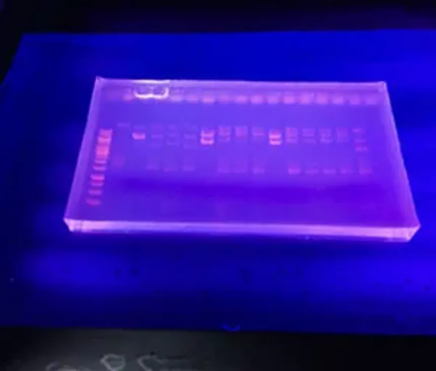 Qué es la Electroforesis: principios y usos