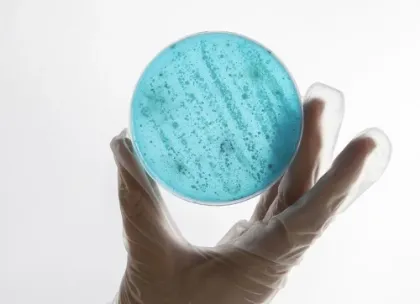 Imagen para la categoría Microbiología Rápida