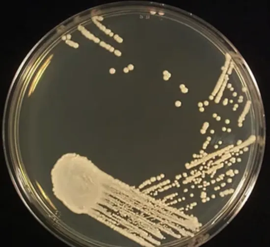 Agar Sabouraud Dextrosa (Al 4%)