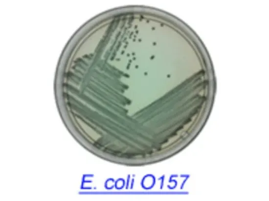 Agar Rainbow para detección de Ecoli  0157 sobre x 30g