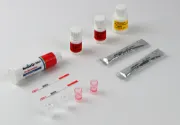 Kit FLUJO LATERAL Reveal® Q+MAX para determinación de Micotoxinas x 25u.
