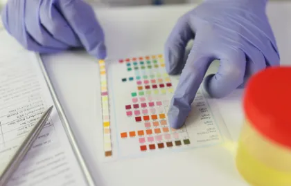 Imagen para la categoría Pruebas Bioquímicas e Identificación
